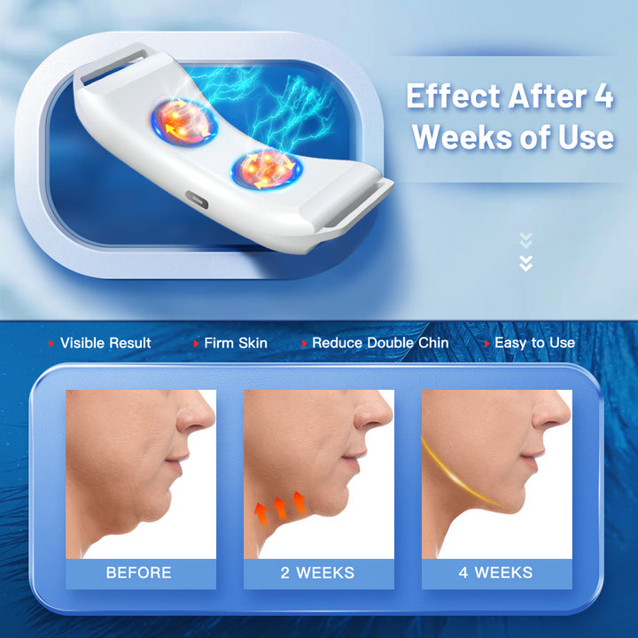 Premium Vibration Chin-Up Facial Lifting Massager – EMS V-Line Beauty Device for Double Chin Removal, Face Shaping, and Skin 